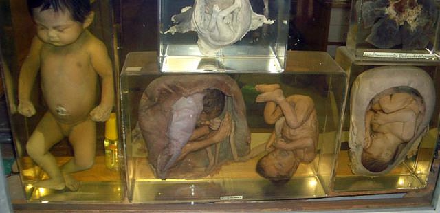 Siriraj Medical Museum
